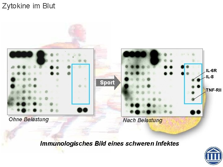 Zytokine im Blut IL-6 R IL-8 Sport TNF-RII Ohne Belastung Nach Belastung Immunologisches Bild