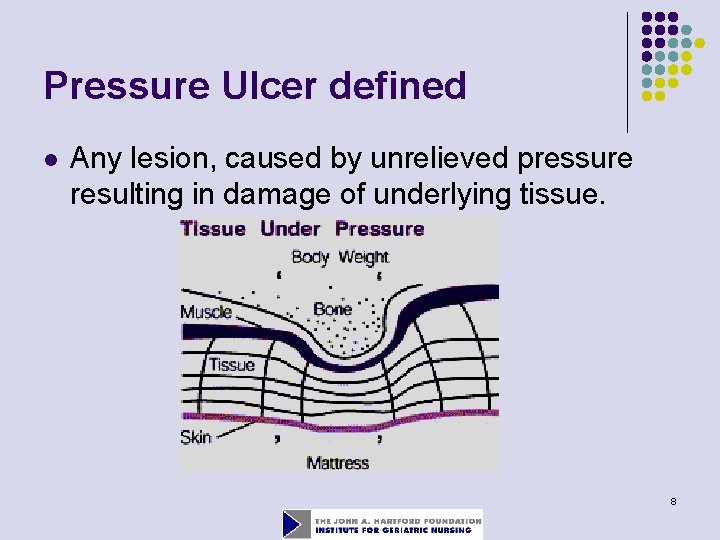 Pressure Ulcer defined l Any lesion, caused by unrelieved pressure resulting in damage of