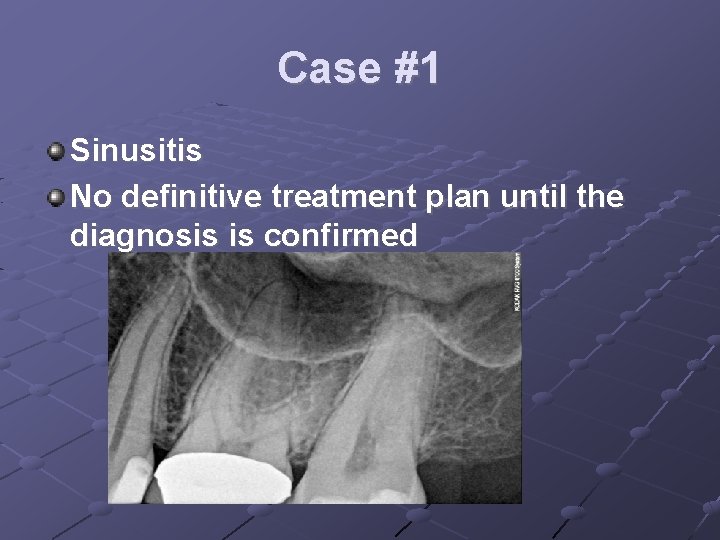 Case #1 Sinusitis No definitive treatment plan until the diagnosis is confirmed 