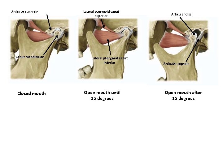 Articular tubercle Caput mandibulae Closed mouth Lateral pterygoid caput superior Lateral pterygoid caput inferior