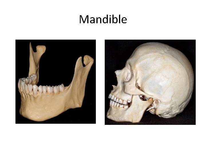 Mandible 