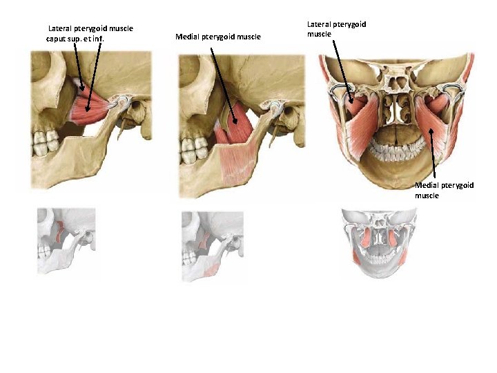 Lateral pterygoid muscle caput sup. et inf. Medial pterygoid muscle Lateral pterygoid muscle Medial