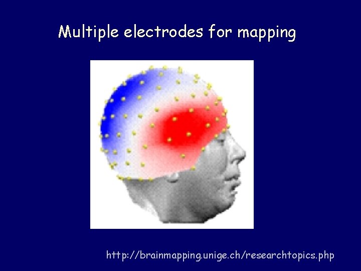 Multiple electrodes for mapping http: //brainmapping. unige. ch/researchtopics. php 