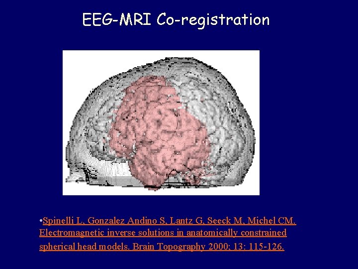 EEG-MRI Co-registration • Spinelli L, Gonzalez Andino S, Lantz G, Seeck M, Michel CM.