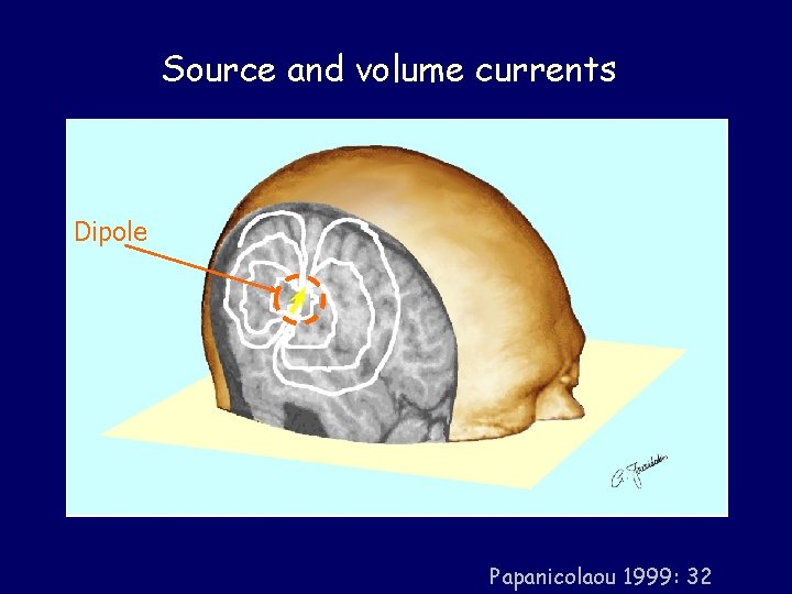 Source and volume currents Dipole Papanicolaou 1999: 32 