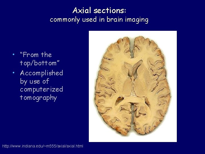 Axial sections: commonly used in brain imaging • “From the top/bottom” • Accomplished by