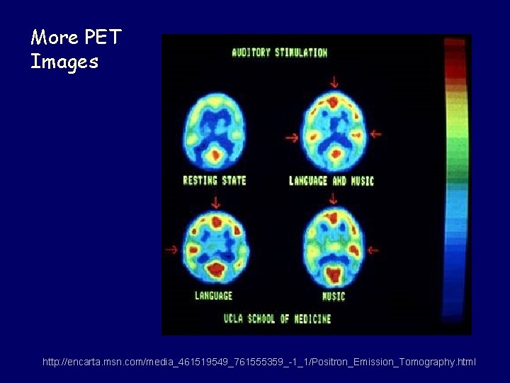 More PET Images http: //encarta. msn. com/media_461519549_761555359_-1_1/Positron_Emission_Tomography. html 