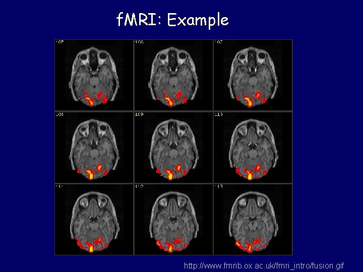 f. MRI: Example http: //www. fmrib. ox. ac. uk/fmri_intro/fusion. gif 