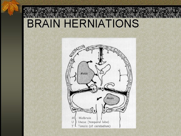 BRAIN HERNIATIONS 