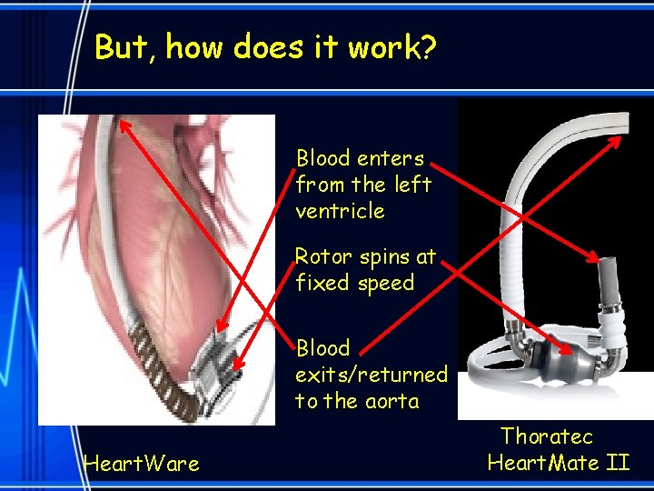 But, how does it work? Blood enters from the left ventricle Rotor spins at