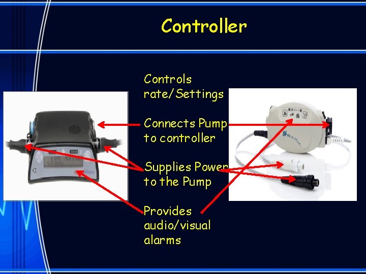 Controller Controls rate/Settings Connects Pump to controller Supplies Power to the Pump Provides audio/visual
