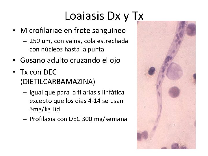 Loaiasis Dx y Tx • Microfilariae en frote sanguíneo – 250 um, con vaina,