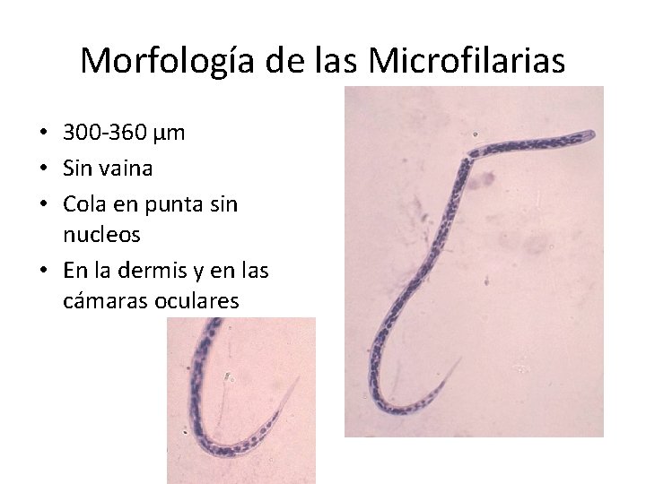 Morfología de las Microfilarias • 300 -360 µm • Sin vaina • Cola en