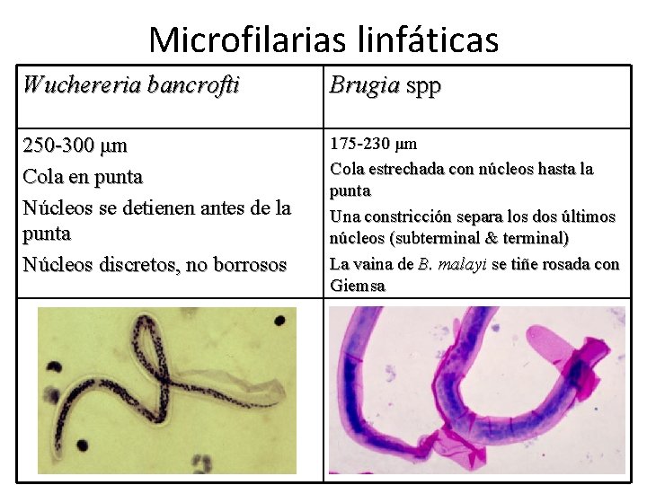 Microfilarias linfáticas Wuchereria bancrofti Brugia spp 250 -300 μm Cola en punta Núcleos se