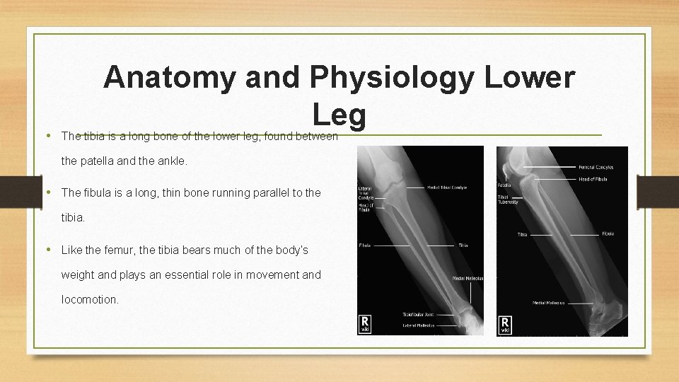 Anatomy and Physiology Lower Leg • The tibia is a long bone of the