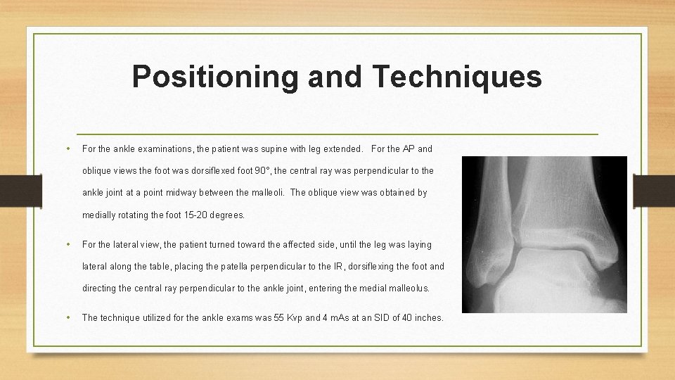Positioning and Techniques • For the ankle examinations, the patient was supine with leg