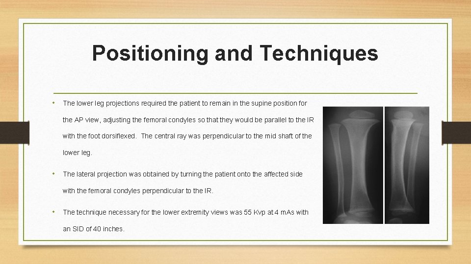 Positioning and Techniques • The lower leg projections required the patient to remain in