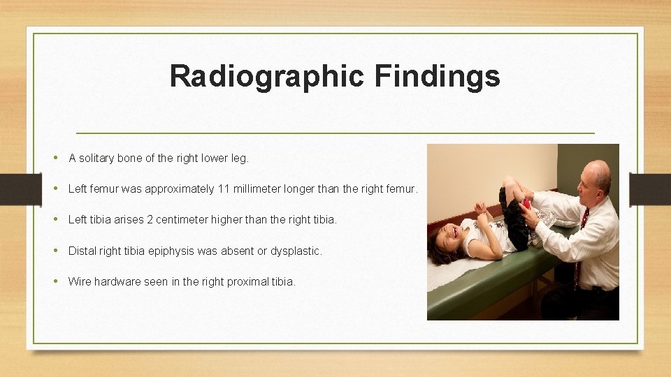 Radiographic Findings • A solitary bone of the right lower leg. • Left femur