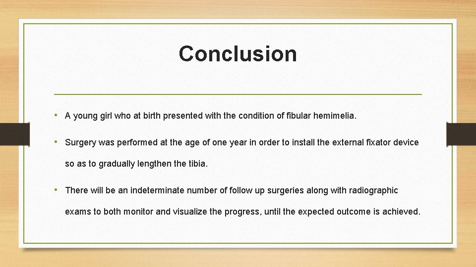 Conclusion • A young girl who at birth presented with the condition of fibular