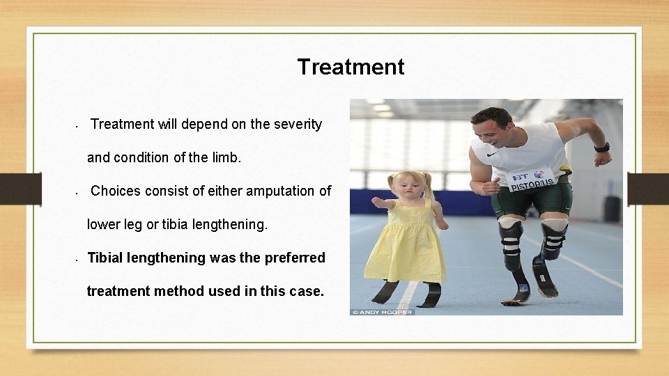 Treatment • Treatment will depend on the severity and condition of the limb. •