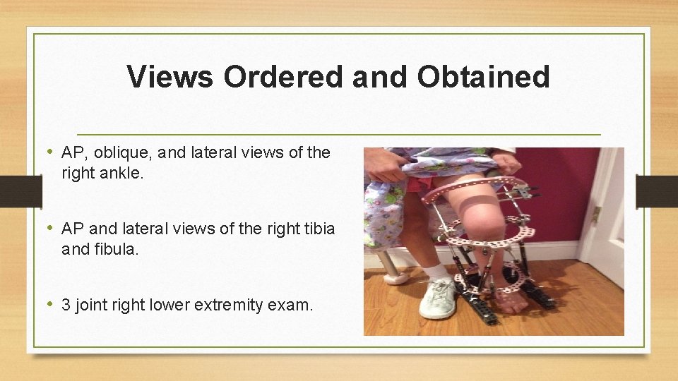 Views Ordered and Obtained • AP, oblique, and lateral views of the right ankle.