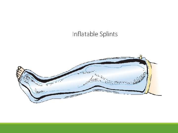 Inflatable Splints 