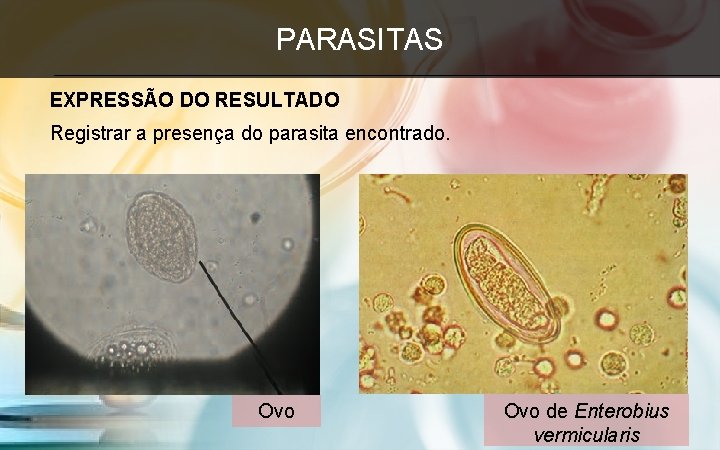 PARASITAS EXPRESSÃO DO RESULTADO Registrar a presença do parasita encontrado. Ovo de Enterobius vermicularis