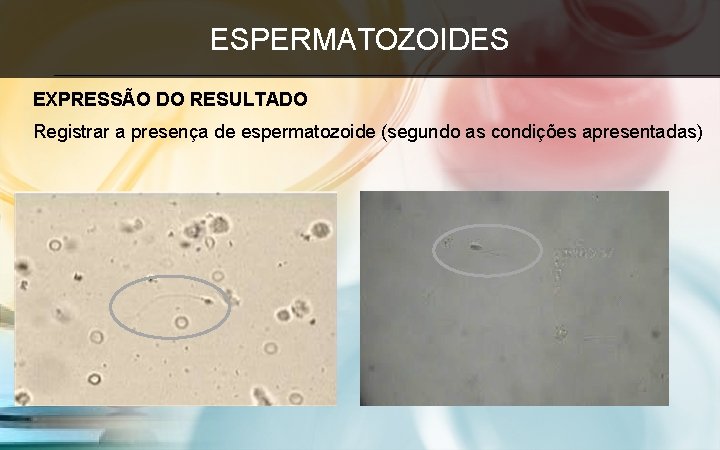ESPERMATOZOIDES EXPRESSÃO DO RESULTADO Registrar a presença de espermatozoide (segundo as condições apresentadas) 