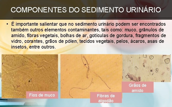 COMPONENTES DO SEDIMENTO URINÁRIO • É importante salientar que no sedimento urinário podem ser