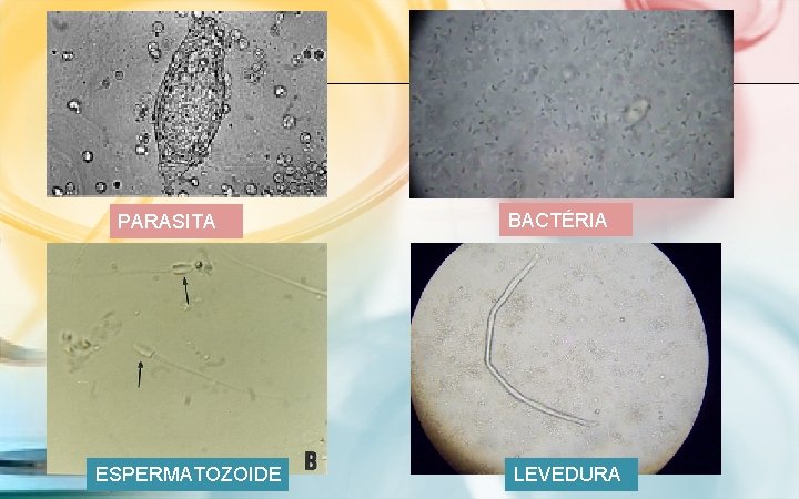PARASITA ESPERMATOZOIDE BACTÉRIA LEVEDURA 