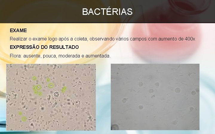 BACTÉRIAS EXAME Realizar o exame logo após a coleta, observando vários campos com aumento