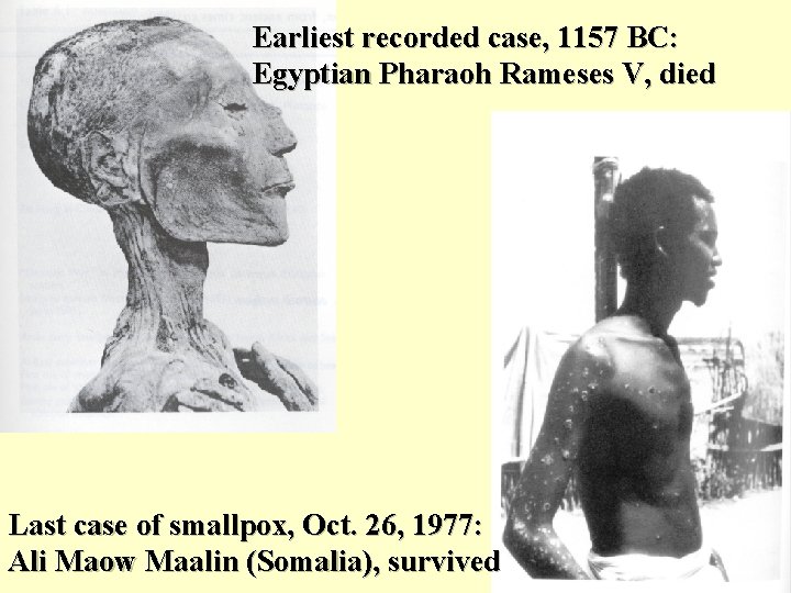 Earliest recorded case, 1157 BC: Egyptian Pharaoh Rameses V, died Last case of smallpox,