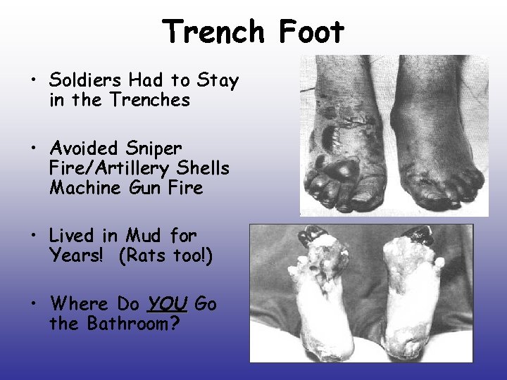 Trench Foot • Soldiers Had to Stay in the Trenches • Avoided Sniper Fire/Artillery