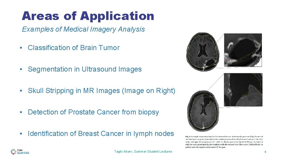 Areas of Application Examples of Medical Imagery Analysis • Classification of Brain Tumor •