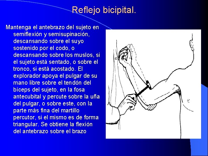 Reflejo bicipital. Mantenga el antebrazo del sujeto en semiflexión y semisupinación, descansando sobre el