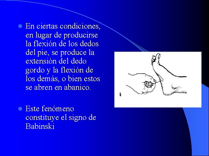 l En ciertas condiciones, en lugar de producirse la flexión de los dedos del