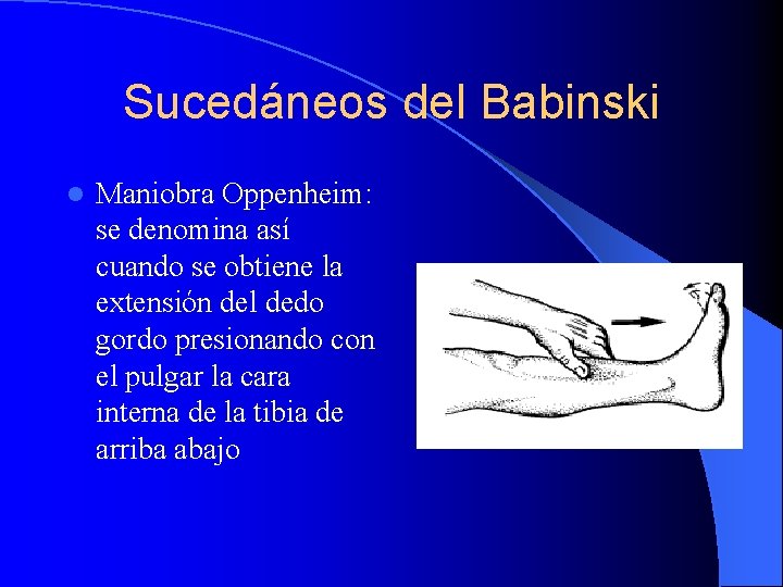 Sucedáneos del Babinski l Maniobra Oppenheim: se denomina así cuando se obtiene la extensión