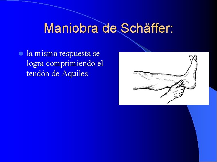 Maniobra de Schäffer: l la misma respuesta se logra comprimiendo el tendón de Aquiles