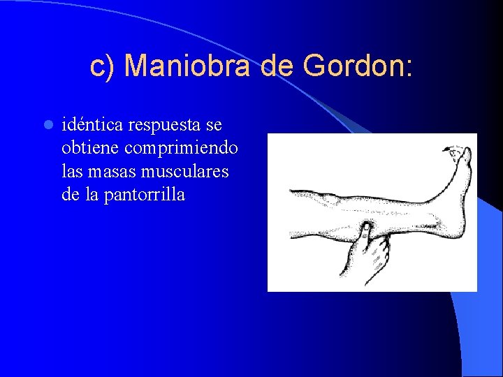 c) Maniobra de Gordon: l idéntica respuesta se obtiene comprimiendo las masas musculares de