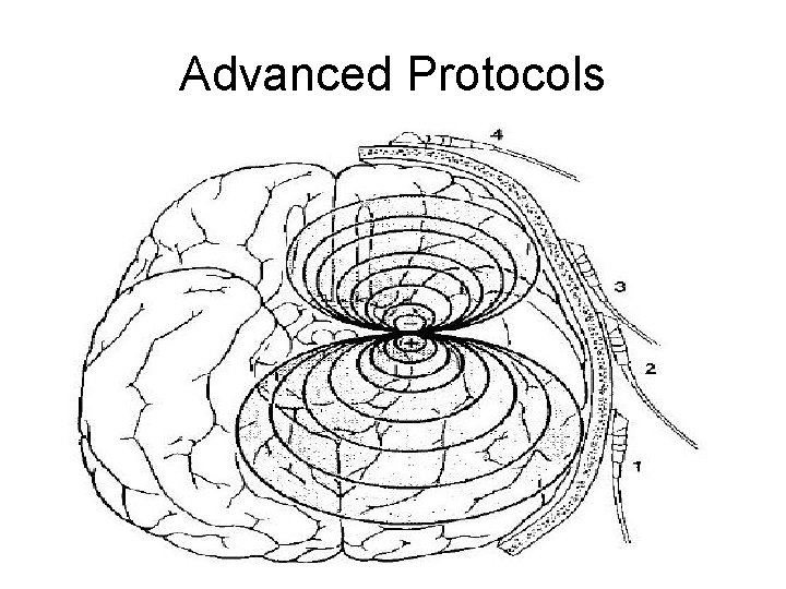 Advanced Protocols 