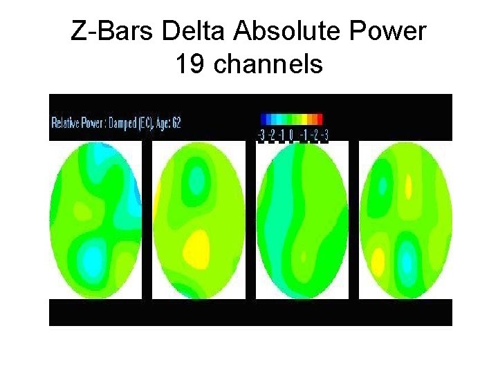 Z-Bars Delta Absolute Power 19 channels 