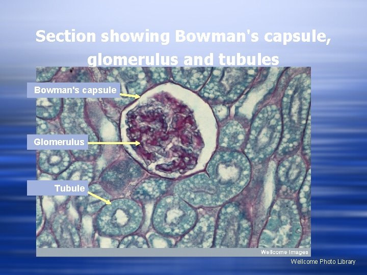 Section showing Bowman's capsule, glomerulus and tubules Bowman's capsule Glomerulus Tubule Wellcome Photo Library