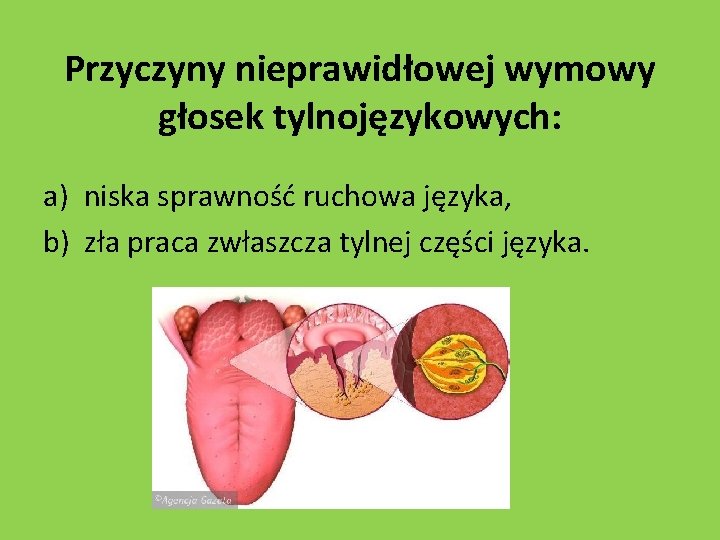 Przyczyny nieprawidłowej wymowy głosek tylnojęzykowych: a) niska sprawność ruchowa języka, b) zła praca zwłaszcza