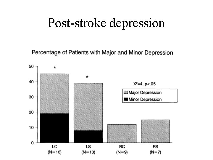 Post-stroke depression 