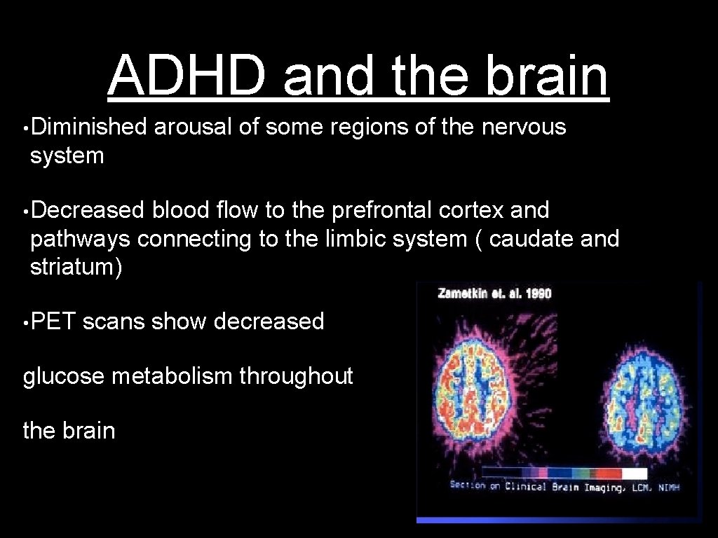 ADHD and the brain • Diminished arousal of some regions of the nervous system