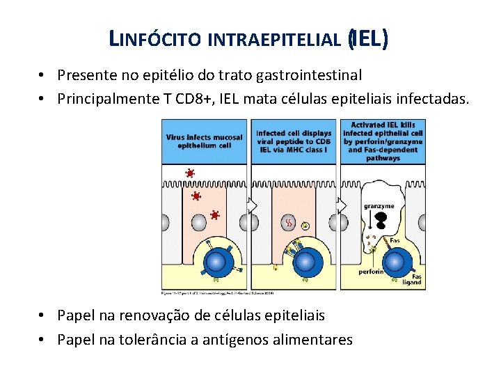 LINFÓCITO INTRAEPITELIAL (IEL) • Presente no epitélio do trato gastrointestinal • Principalmente T CD