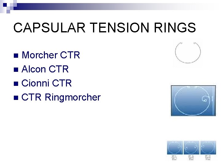 CAPSULAR TENSION RINGS Morcher CTR n Alcon CTR n Cionni CTR n CTR Ringmorcher