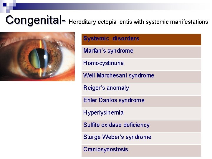  Congenital- Hereditary ectopia lentis with systemic manifestations Systemic disorders Marfan’s syndrome Homocystinuria Weil