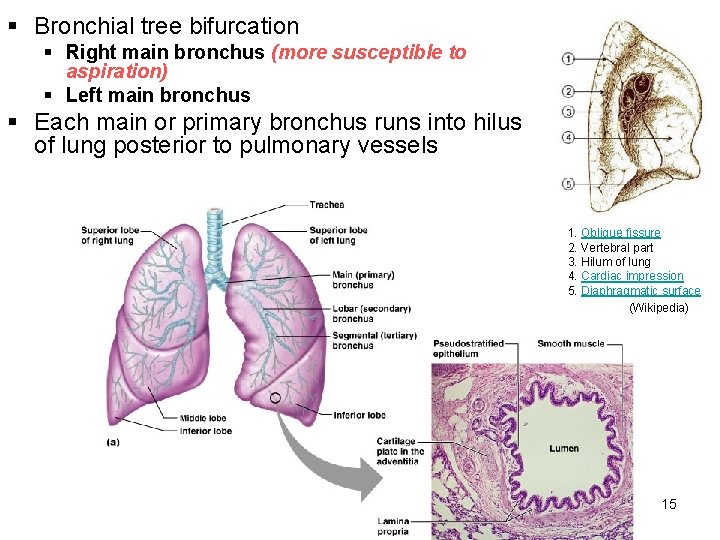§ Bronchial tree bifurcation § Right main bronchus (more susceptible to aspiration) § Left