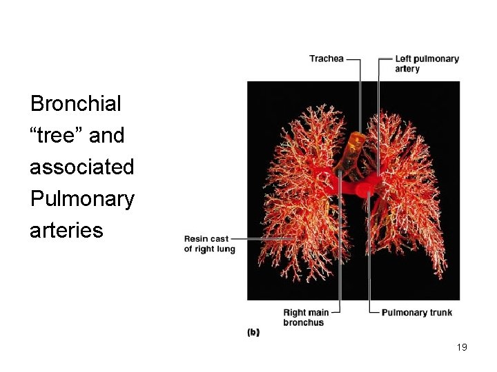 Bronchial “tree” and associated Pulmonary arteries 19 